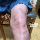 중앙의지보조기 이미지