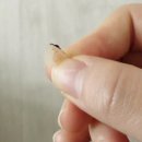 안양스티카 | 안양 점 제거 후기｜얼굴과 목 점이 신경 쓰여 방문한 기록