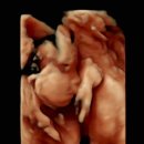 153약국 | 너무 하기 싫었던 임당 재검 후기(결과는 확정🤣)