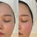 웨딩전 관리 필수 안산 윤곽관리 추천 메이에르 안산점 후기