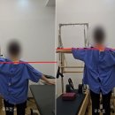 이르필라테스 | (우아동 필라테스)회전근개 파열 후 어깨회복, 피지오모션과 함께