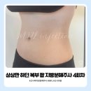 상상의원 - 서구 대덕대로 203 | 상상 복부 팔뚝 지방분해주사의원 4회차 후기, 몸무게 앞자리 변화