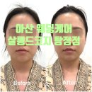 [아산] 아산 웨딩케어샵, 살롱드코지 하이푸 후기