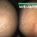 심플리스토리