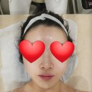 가수원상점가 | 대전 가수원 피부관리샵 &#34;뷰티다룸&#34; 물광톡스 후기