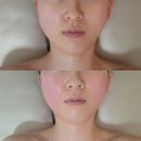 월배지구대 | 대구 달서구 피부관리 추천ㅣ역대급 가성비 손맛 좋은 원장님의 수기 윤곽관리 후기ㅣ그언니샵 스킨앤바디