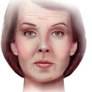 메디컬센터 | 🛏 수면자세가 왜 주름을 만든다고 하나요? 김해주름관리. 김해피부과,김해이마보톡스, 김해보톡스후기