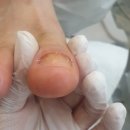푸스케어대전신탄진점 네이버블로그