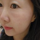 북영덕농협 축산지점 | 원흥피부관리 슈퍼젝션 효과 vs 부작용? 제이드스킨랩에서 직접 받은 리얼후기