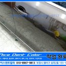 소사덴트 이미지