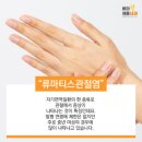 천안나은병원 | 천안 류마티스 내과 두 군데 다녀본 후 시작한 관절염 관리 후기