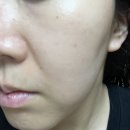 아워즈 | 히알루론산 앰플 추천 17아워즈 동결건조 히알루론산 앰플 솔직후기