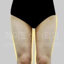 레아트성형외과의원 이미지