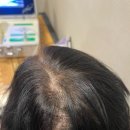 명장2 치안센터 | 두피관리 추천 엄마와 함께한 창원탈모전문 명장두피탈모관리센터 창원두피케어 방문후기 상남동두피관리