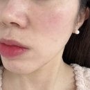 주식회사 바로팩토리 | 트러블세럼 진정세럼 네시픽 시카 피디알엔 세럼 실사용후기