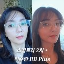 멍이와 양이 | 신사역피부과 스컬트라 2차 내돈내산 후기 리쥬란 HB Plus 4cc 통증 엠보 경과