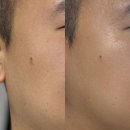남자 스킨 토너 추천 땡큐파머 피토 릴리풀 시카부스팅 토너