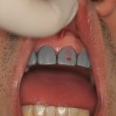 민치아치과기공소 이미지