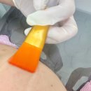 김포 피부관리 구래동 미백 예스뷰티_ 여드름 관리 스피큘 후기