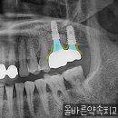 신흥치과기공소 이미지