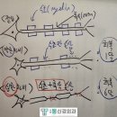 달서구안면마비, 구안와사, 벨마비 자연/자가치유방법, 수술법 [서부통신경외과]대구송현동,상인동,대명동