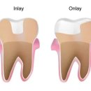 일정치과기공소 이미지