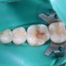 성복정원치과의원 이미지