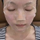 광주사 | 내돈내산 신사역 엘라비에리투오 여드름 피부결 개선 후기(통증, 유지기간,효과)