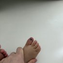 리드힐정형외과의원 | 마이밀밀의 육아일기 - 13개월 아기 낮잠 ·발달 ·식단 / 아기 발톱 피멍 정형외과 방문 기록