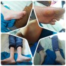 #발관리전문치유센터,Foot Care Professional Healing Center #발마사지,foot massage #발가락교정기,Foot calibrator #정형교정신발,Orthopedic shoes #발 이미지
