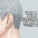 귓불 주름 치명적인 뇌질환의 적신호 맞을까 이미지