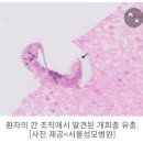 #️⃣분노 와 증오를 다스리는 방법10가지&#34; ❓용서하는 방법을 개발하라&#34;.🆘️고열.복통 간이식 하려했는데...❗알고보니 개회충~ 이미지