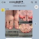 꼬뇨네일