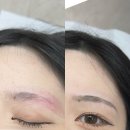 꼼꼬미 | 성수동 눈썹문신 건대 눈썹문신 꼼꼬미 브로우 자연눈썹 후기
