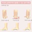 알즈너 점프 대리점 이미지