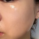 희소성형외과의원 | 기록용] 출산후산후보약대신 줄기세포주사 맞은 후기 -대전 희소성형외과