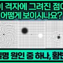 실명 원인 중 하나, 황반변성/흐린 날에도 선글라스 쓰세요/카메라의 필름이 고장 난 현상, 황반변성/부산MBC 190617 방송 이미지