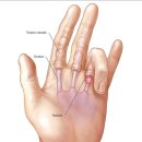 수지로-3 | 방아쇠수지증후군 치료 후기 3탄 (현재 상태와 개인적인 생각)