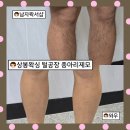 중랑 | 상봉왁싱 털공장 종아리왁싱 후기｜중랑구 남자왁서샵