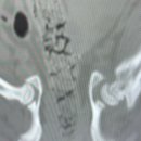 김미경 동물병원 | 아니길 바랬던 8개월에게 너무 가혹한 PS 유전적 폐동맥 협착증 심장병 투병일기 입원 1일차