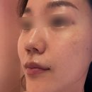 The피부빛나 네이버블로그