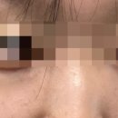 엘리피부과의원 이미지