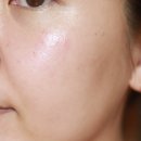 비엔메디 | 비엔뷔 바이오랩 메디스파 MPF앰플 1일/3일 후기