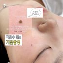 브라운도트 용인점 | 수원 미인점 , 미남점 / 점타투 / 커버업