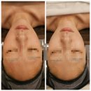 CU 광주쌍령대로점 | 🌿 경기광주 피부관리 맛집 [올가드림뷰티 쌍령점] 후기🌿