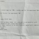 MRI판독지 해석 부탁드립니다. 이미지