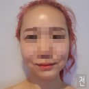 서원동-49 | 신림 피부관리실 박민뷰티라이프 전신관리받고 감동받은 후기