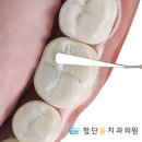 루시드잉글리시&엘수학학원 | 아닌밤에홍두깨아닌블로그