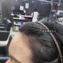 마샬헤어라인 이미지