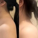 빛날에스테틱 - 전주시 완산구 | 영등포 당산 웨딩관리 더빛날에스테틱 승모근관리 에스테틱 유목민 정착 찐후기